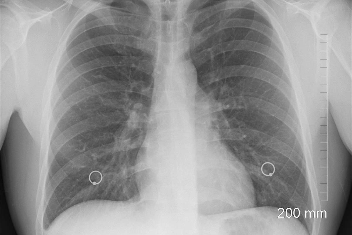 Pulmonary Health