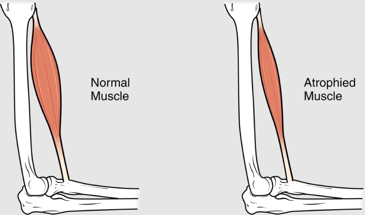 7 muscle loss